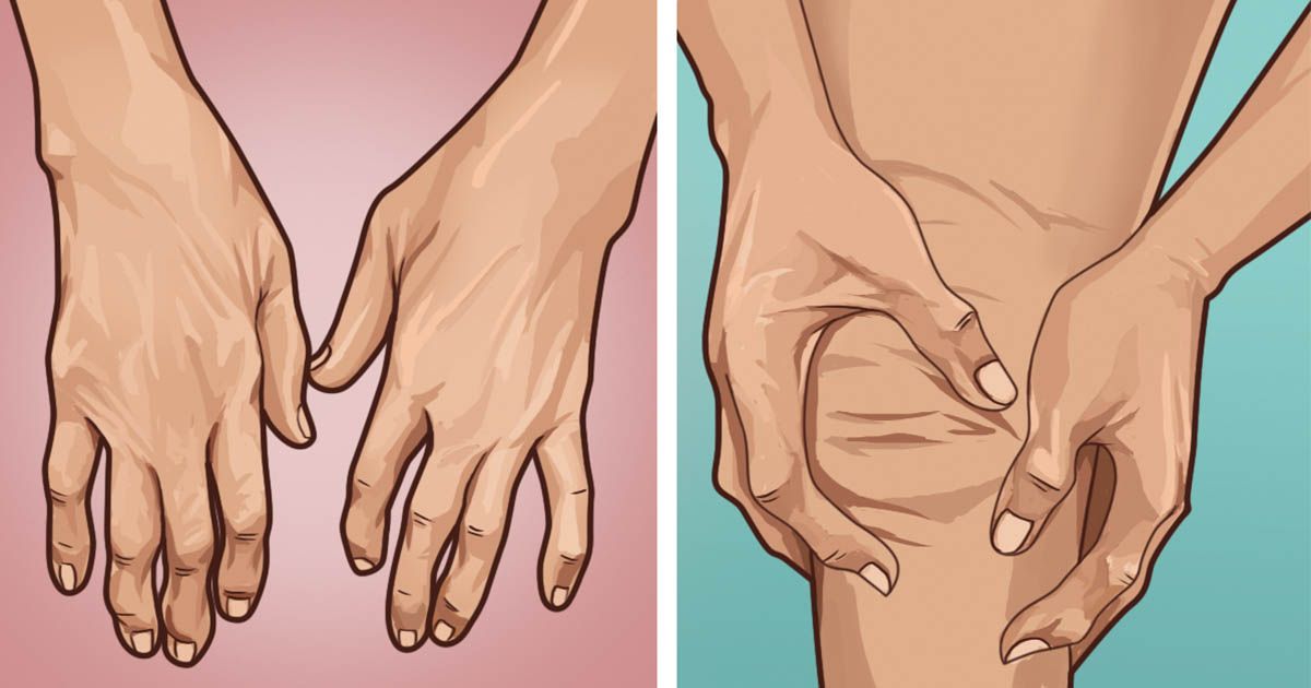 Три распространенных типа артрита: что нужно знать и как устранить
