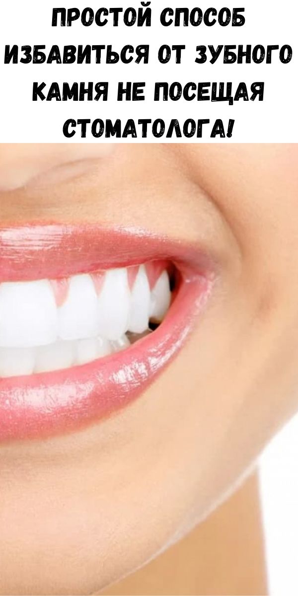 Простой способ избавиться от зубного камня не посещая стоматолога!