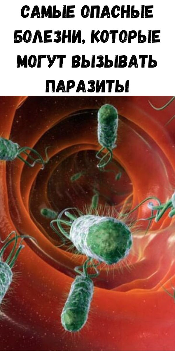 Самые опасные болезни, которые могут вызывать паразиты