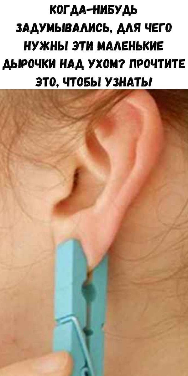 Когда-нибудь задумывались, для чего нужны эти маленькие дырочки над ухом? Прочтите это, чтобы узнать!