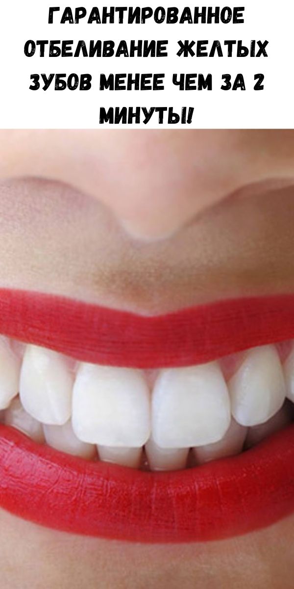 Гарантированное отбеливание желтых зубов менее чем за 2 минуты!
