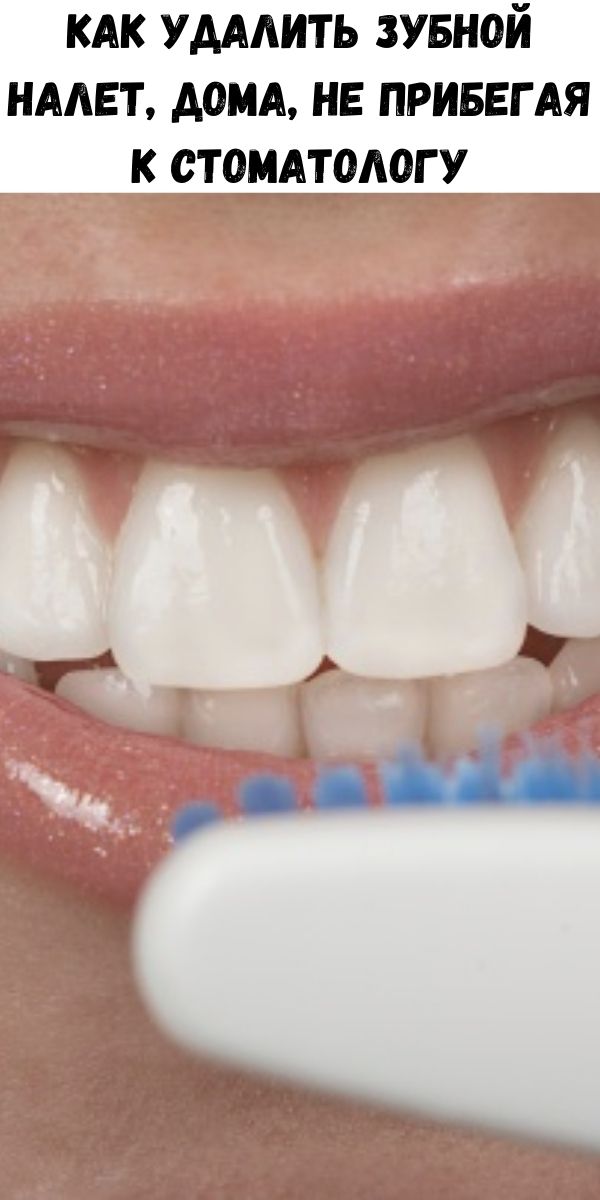 Как удалить зубной налет, дома, не прибегая к стоматологу