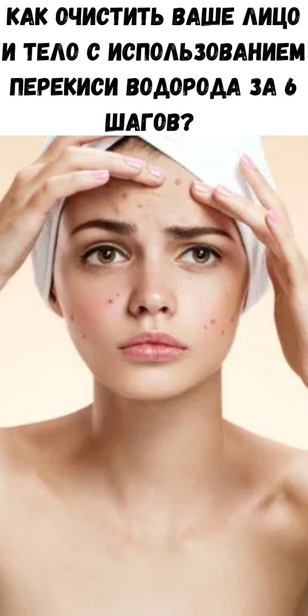 Как очистить ваше лицо и тело с использованием перекиси водорода за 6 шагов? 