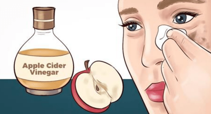 6 удивительных способов улучшить состояние кожи с помощью яблочного уксуса