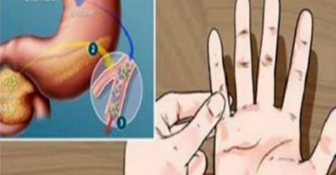 Тест на пальцах для диагностики преддиабета за 1 минуту