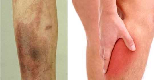 9 проблем со здоровьем ног, которые могут сигнализировать о серьезной болезни