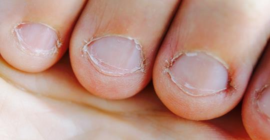 Исследователи объясняют, что о вас говорит то, что вы грызете ногти