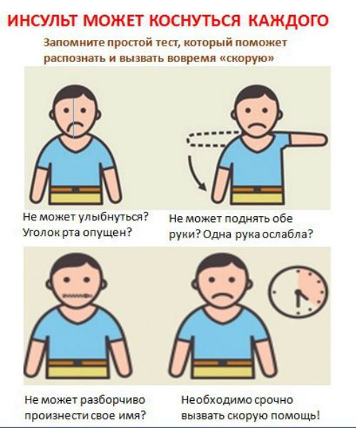 Инсульт: запомните 3 элементарных шага, чтобы спасти чужую или даже свою ЖИЗНЬ!