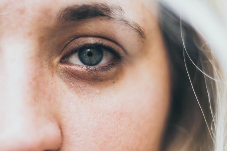 11 эффективных советов, как избавиться от темных кругов и опухших глаз
