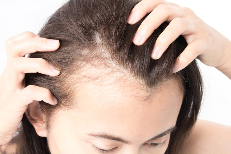 Нанесите несколько капель сыворотки на кожу головы и увидите, как выпавшие волосы отрастут…Удивительно!